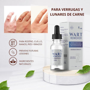 WART REMOVER - REMOVEDOR DE VERRUGAS Y LUNARES